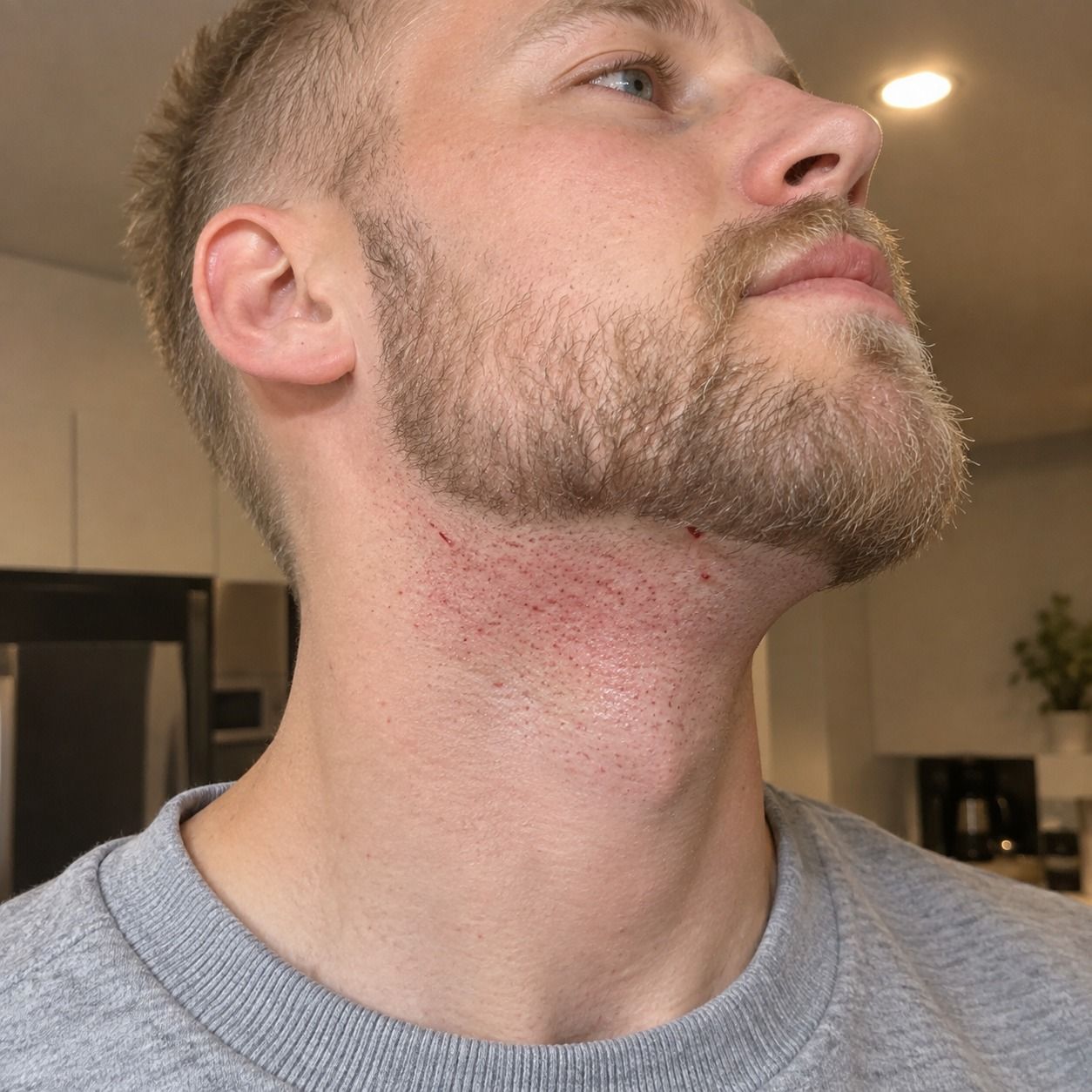 Beard line, before