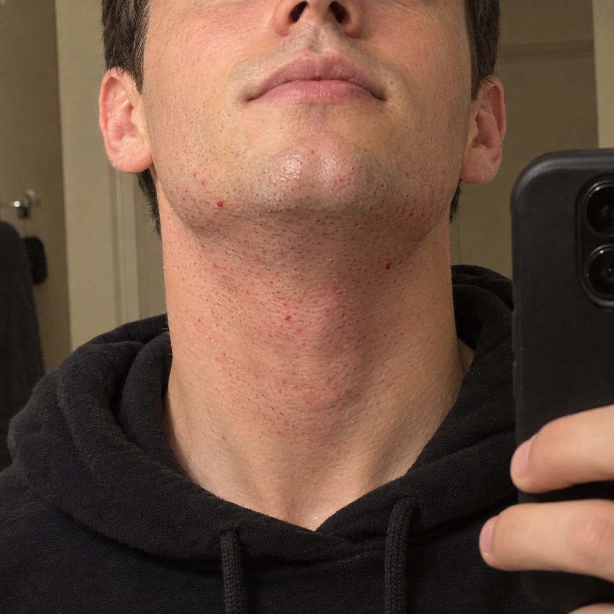Neck, before