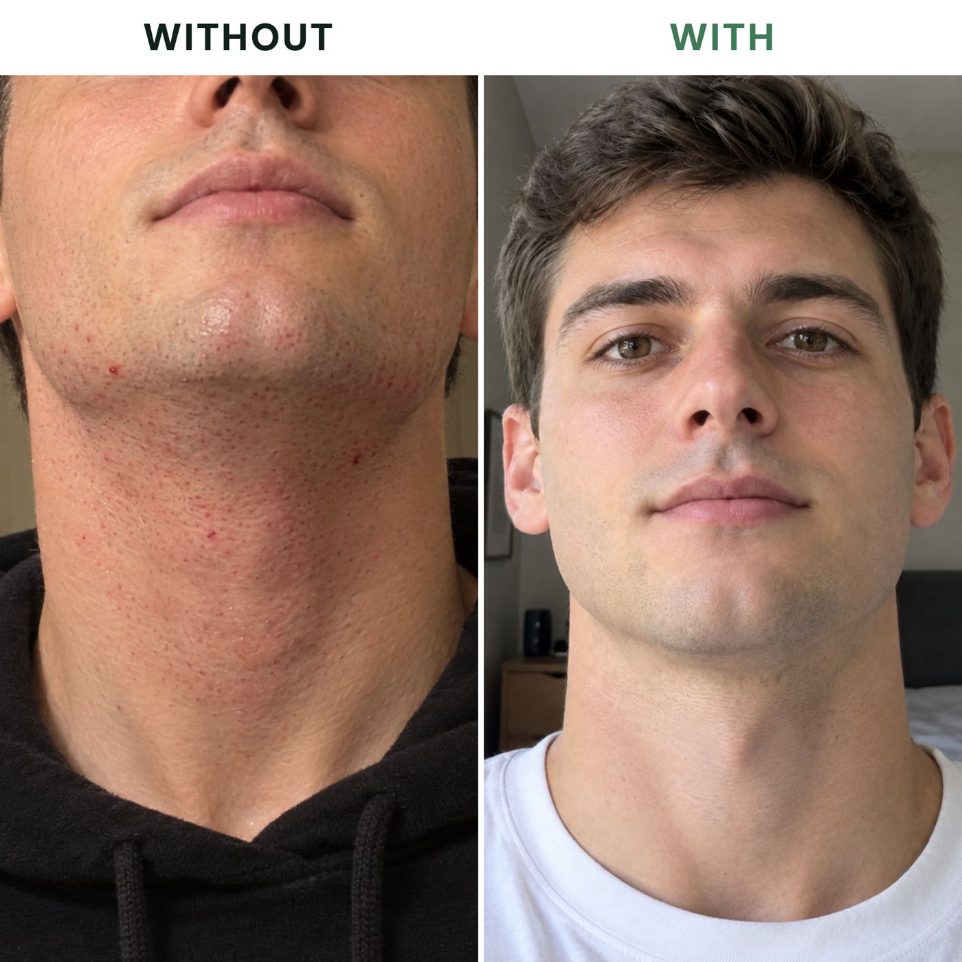 Before and after