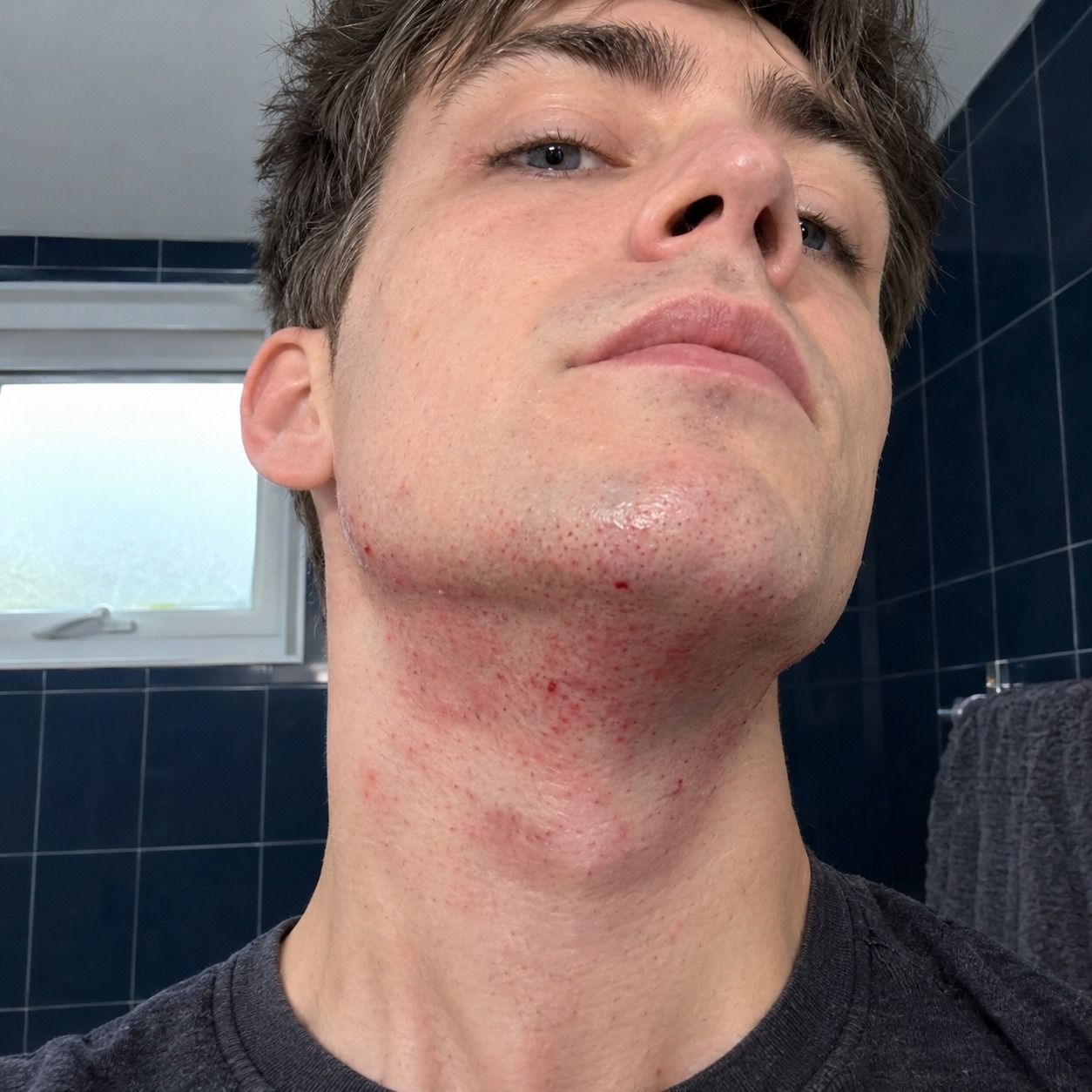Red dots on a freshly shaved neck