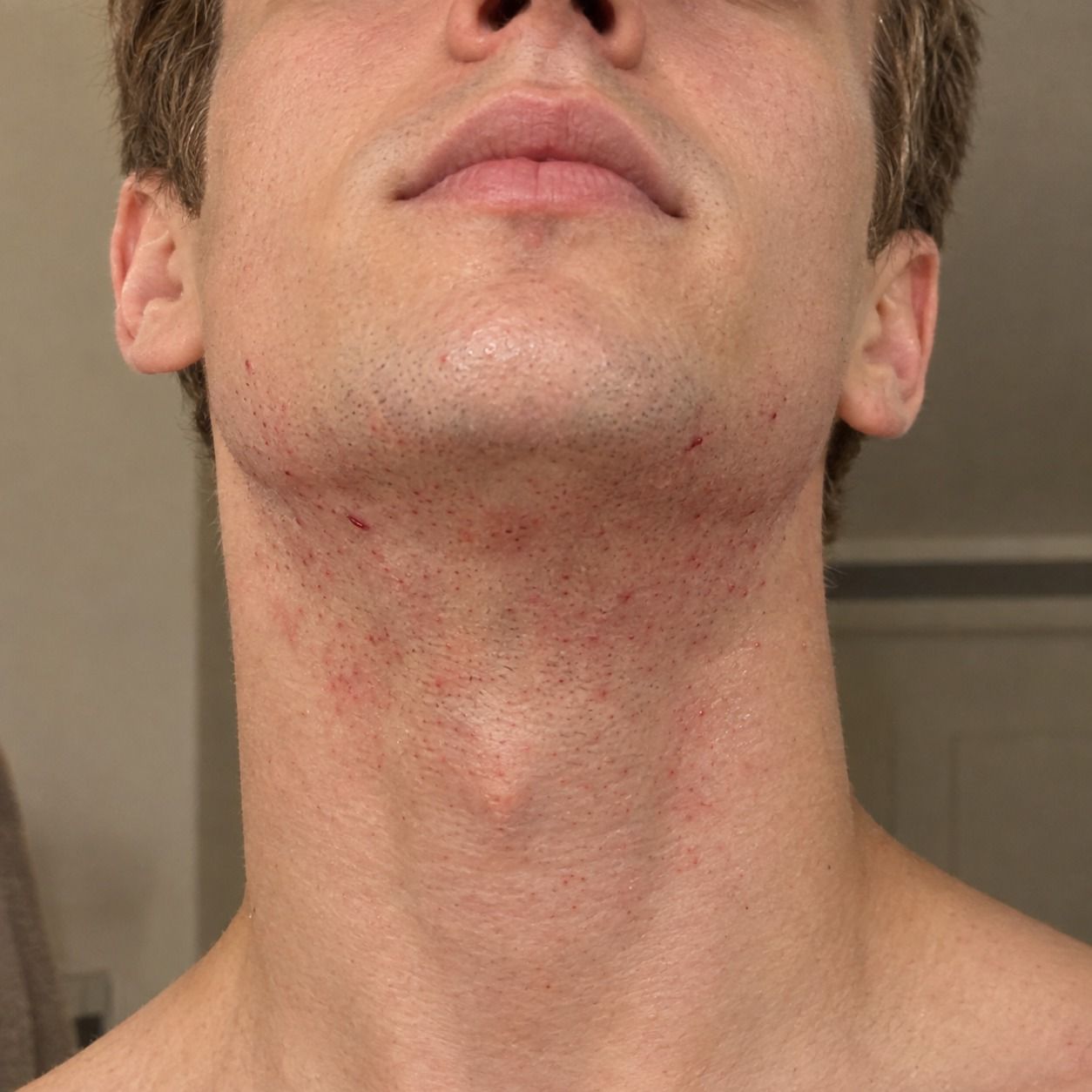 Neck, before