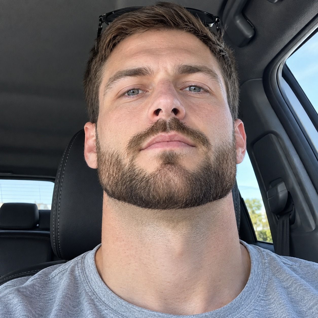 Beard line, after